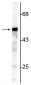 Anti-Vimentin Antibody